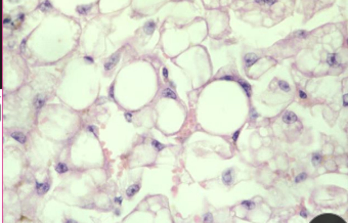 <p>lipid</p><p>displaced nuclei,</p>