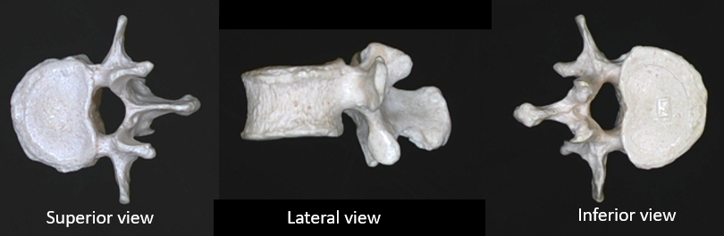 from which region does this vertebra originate 