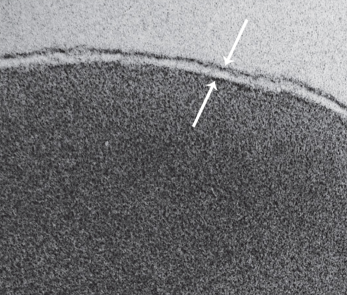 <p>The most studied cell membrane - <strong>trilaminar</strong> structure made of a <strong>phospho<u>lipid</u> bilayer</strong>.</p><p>~ 6 nm thick, very consistent between cell types.</p><p>Makes up the outermost layer of cells.</p>