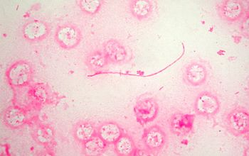 <p></p><p><strong>Pink rods (Gram-negative bacillus (round), stains faintly).</strong></p><p>Type: Bacteria; Disease: Legionnaires' disease (severe pneumonia) or<strong> Pontiac fever</strong> (milder);</p><p>Diagnosis: Urine antigen test, special culture (BCYE agar), chest X-ray;</p><p>Treatment/Prevention: Macrolides or fluoroquinolones; disinfect water systems;</p><p>Spread/Unique: <strong>Lives in warm wate</strong>r (AC, fountains); spread by inhaling mist (not person-to-person).</p>