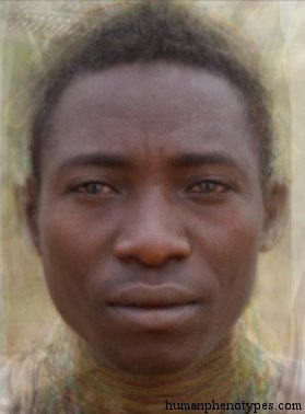 <p>Identify this Phenotype</p>