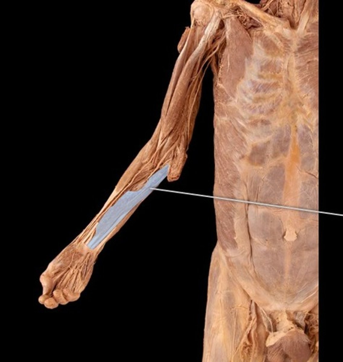 <p>What muscle is this?</p>
