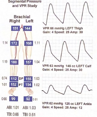 <p>What does the following VPR exam suggest?</p>