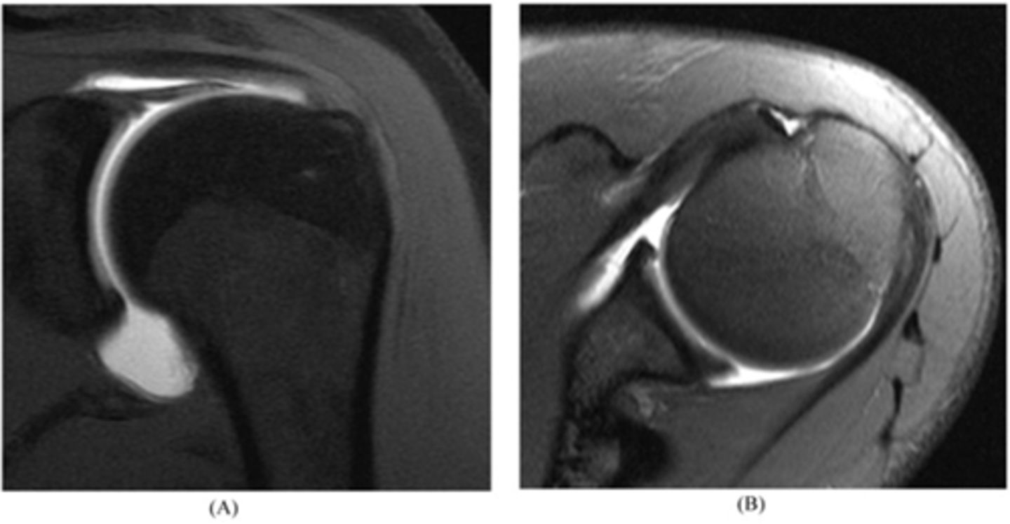 <p>What are these images depicting? How do you know?</p>