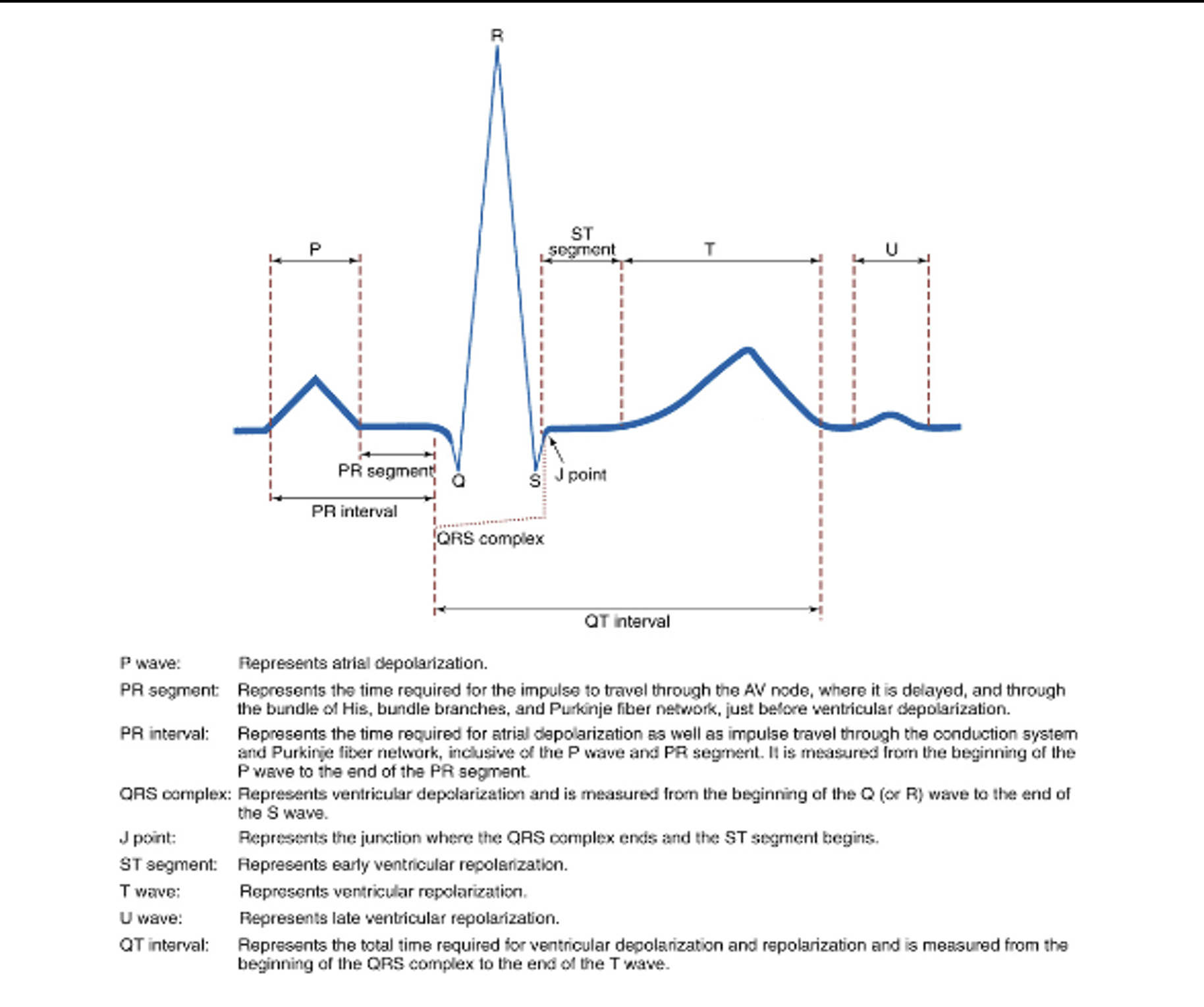 <p>EKG Basics</p>