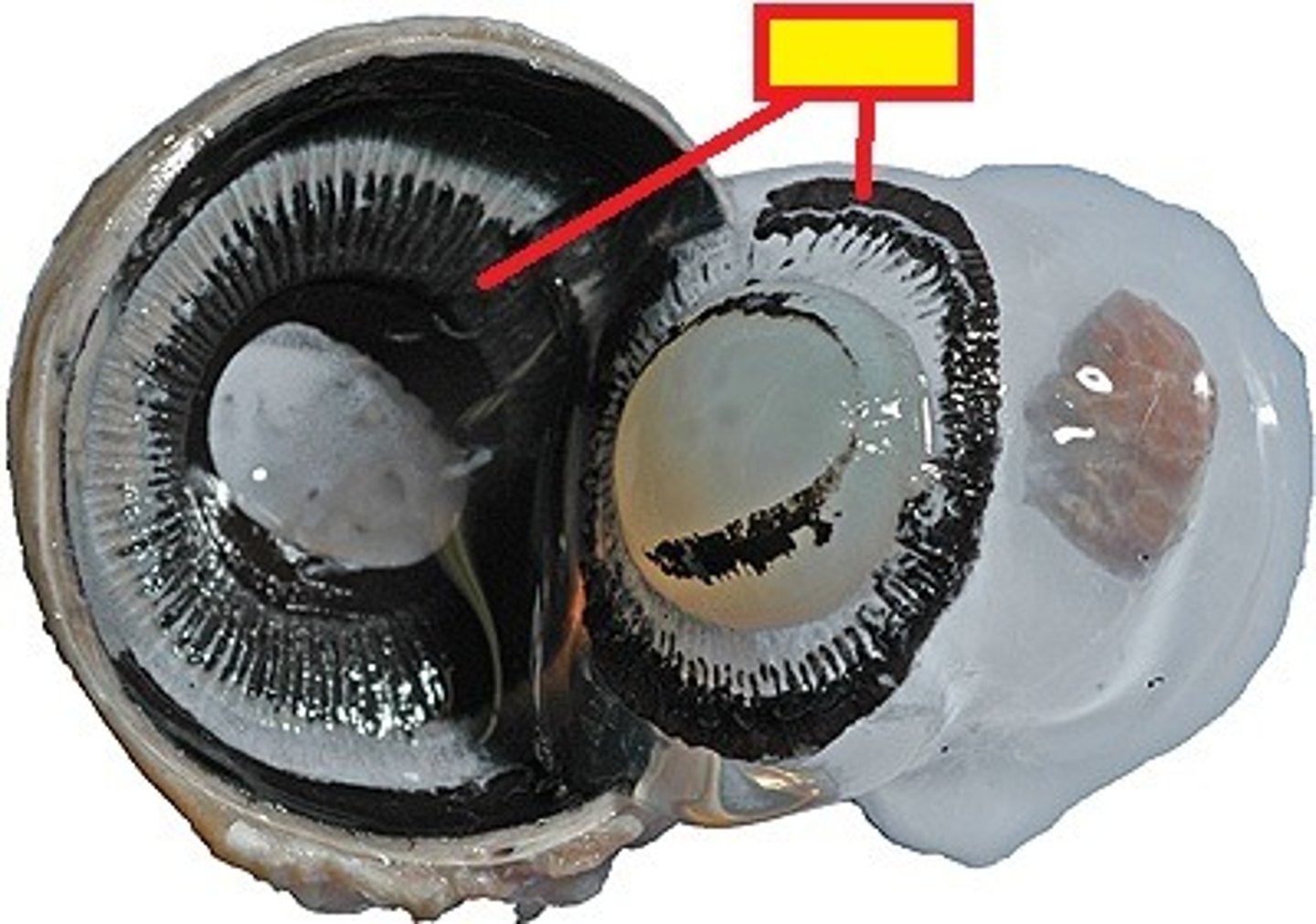 <p>ring of tissue behind the peripheral iris that is composed of ciliary muscle and ciliary processes</p>