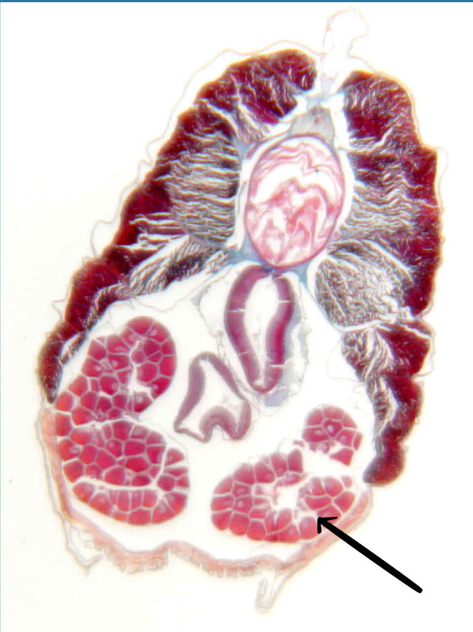 term image
