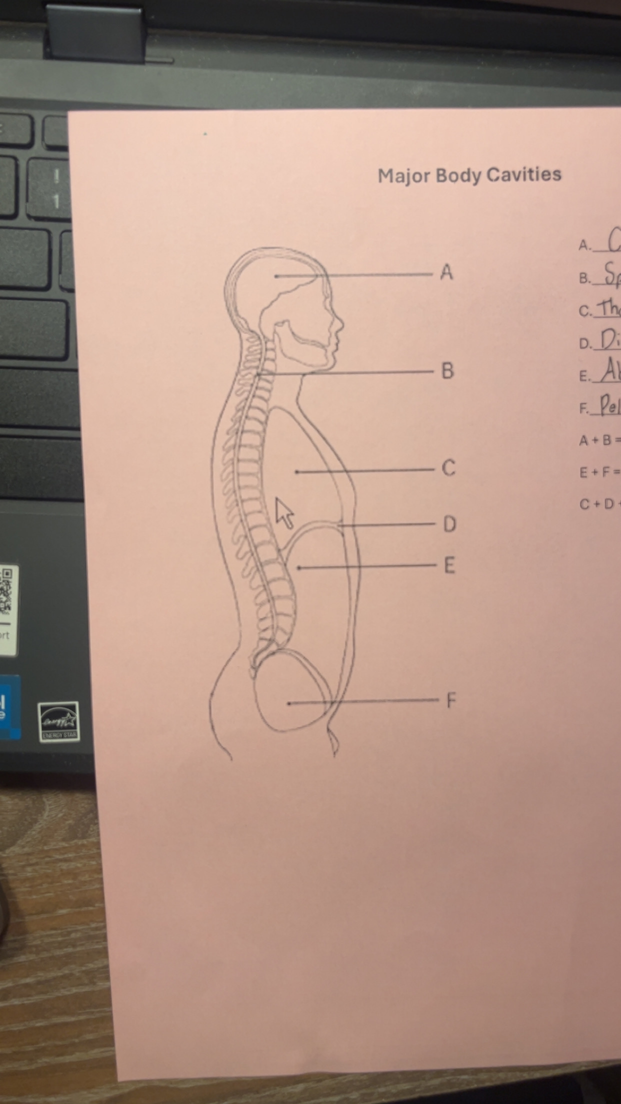 <p>What cavity is D</p>