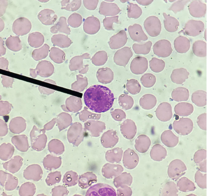 <p>What is the name of the stain used in the direct counting of this cell?</p>