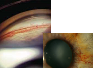 <p>identify </p>
