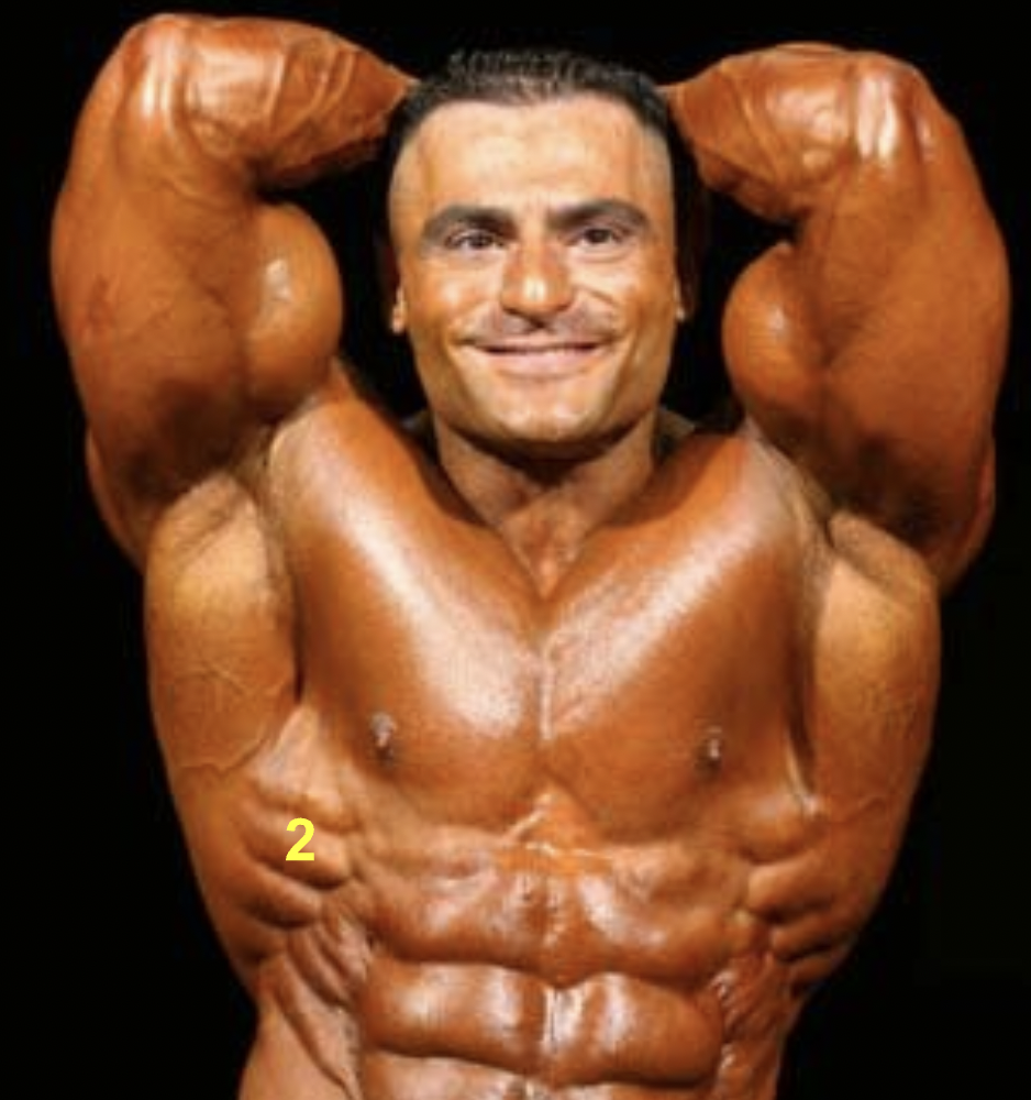 <p>What muscle is indicated by “2”?</p>