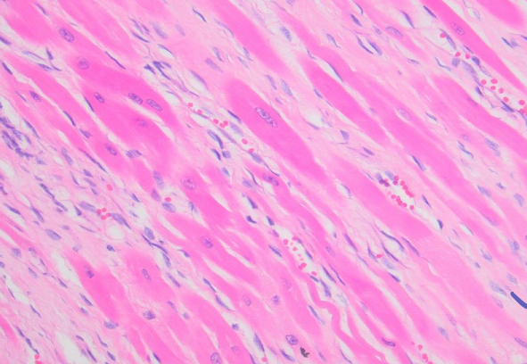 <p>what is being shown in the pale pink matrix**</p>