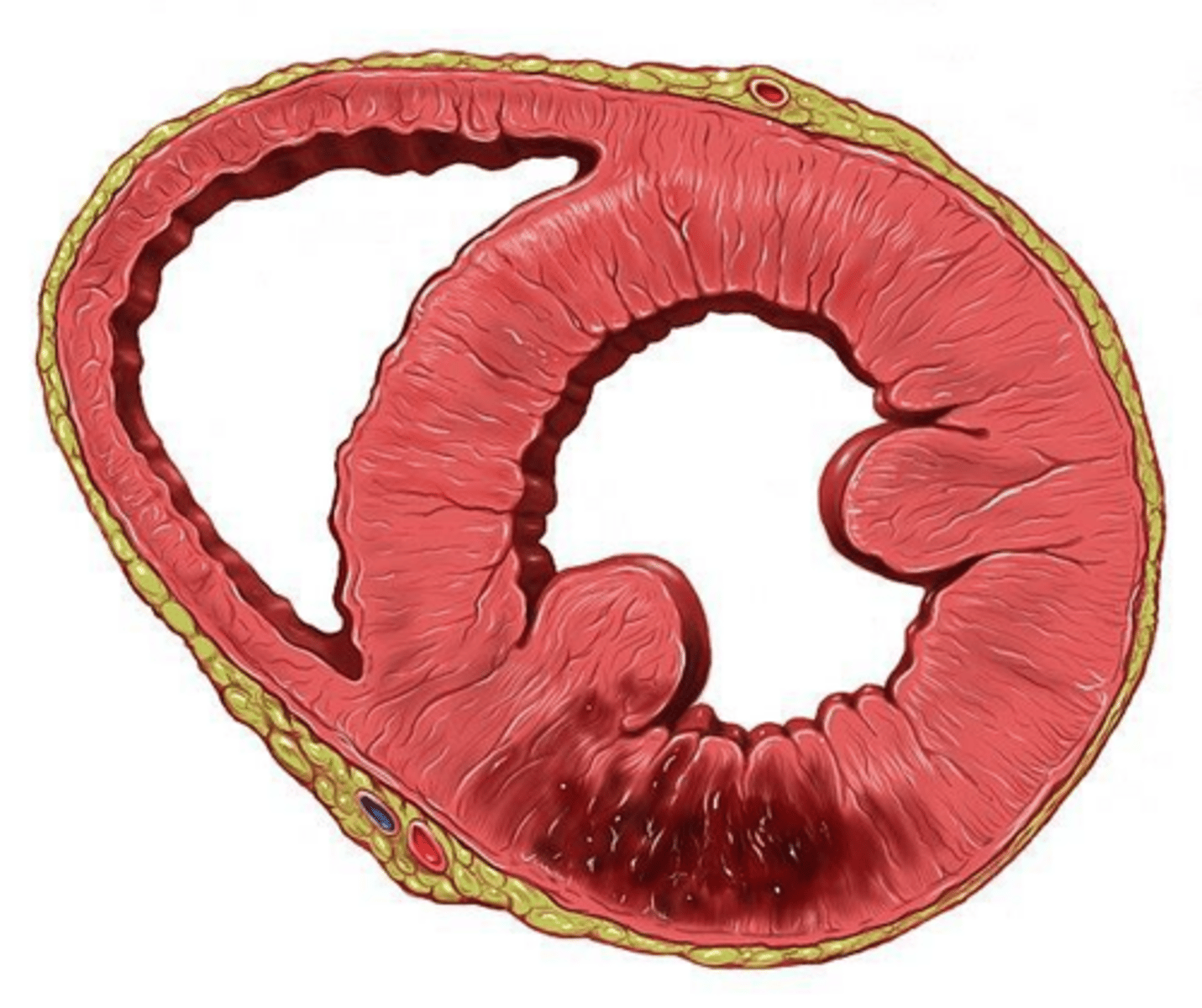 <p>Ventricular tachycardia, ventricular fibrillation, bradyarrhythmias, and heart block.</p>