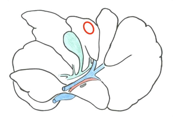 <p>Leverns “fyrkantiga” flik</p>