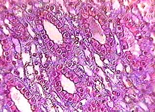 <p>What is this tissue?</p>