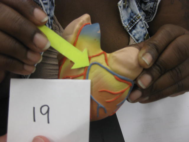 <p>Body Systems</p><p>Lab Image 1-26</p>