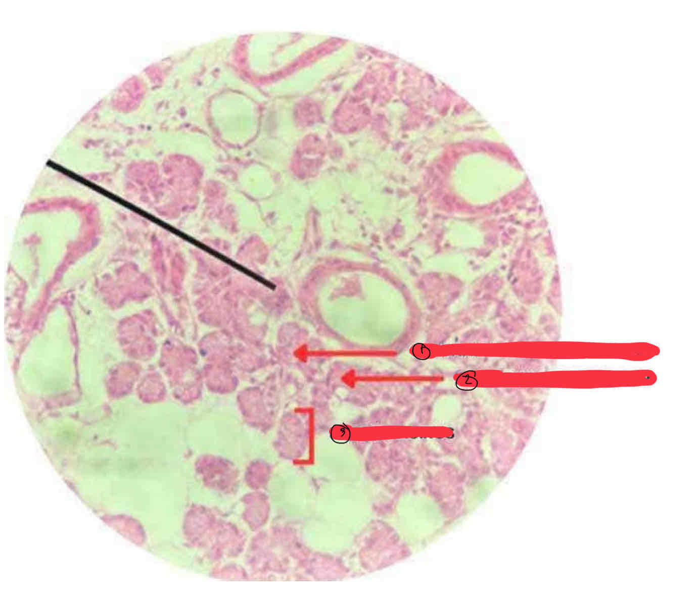 <p>Parotid Gland</p>