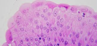 <p>Stratified epithelium that stretches; lines urinary bladder, ureters, and proximal urethra.</p>