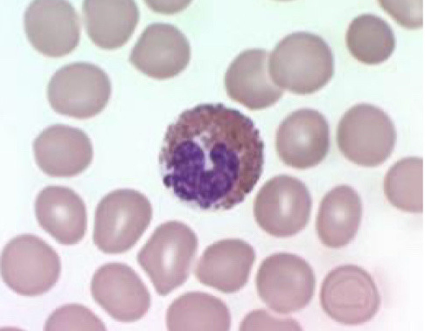 <p>What type of WBC is seen in this image?</p>