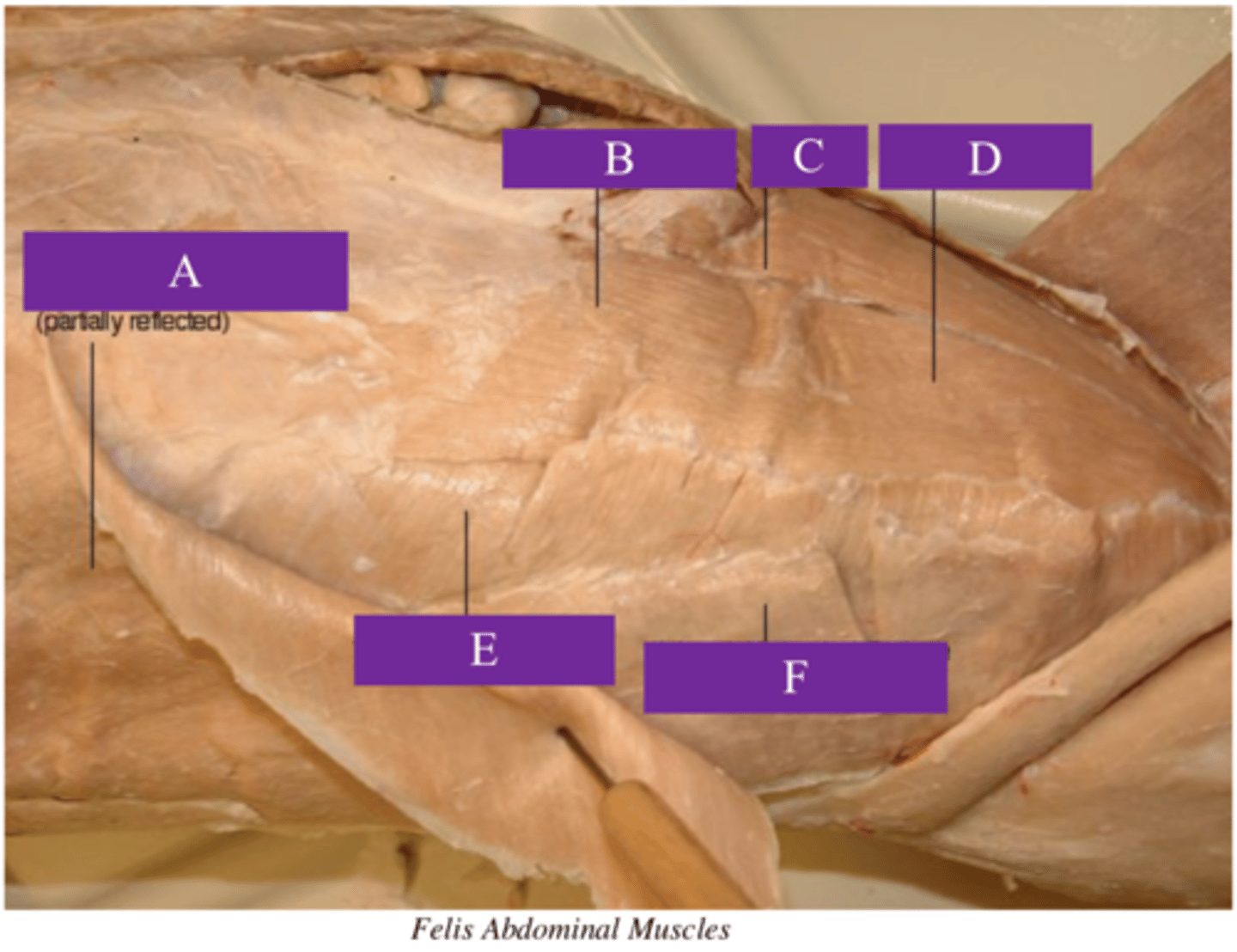 <p>What is letter D?</p>