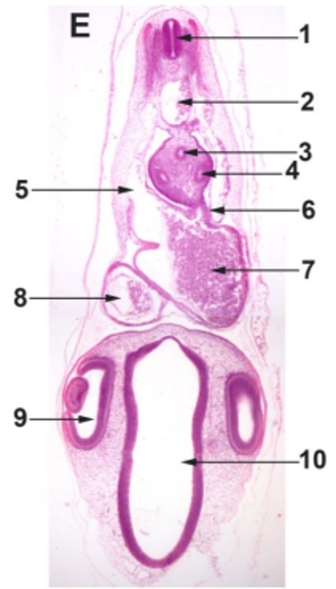 <p>#8 mesoderm</p>