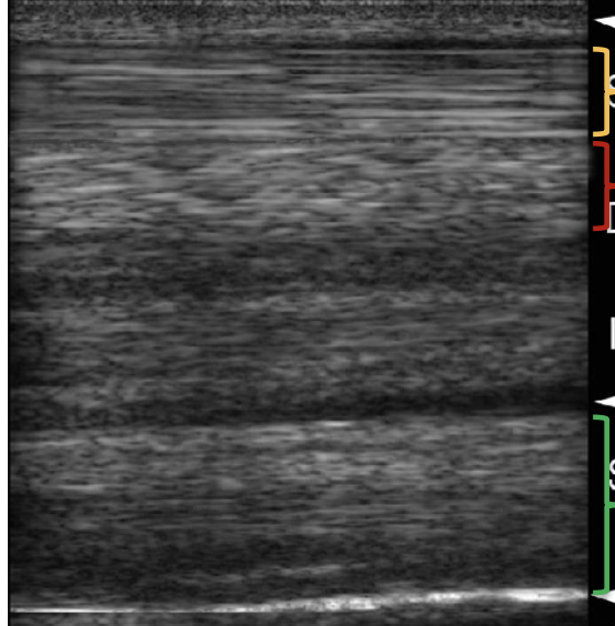 <p>what structure is indicated by the yellow bracket?</p>