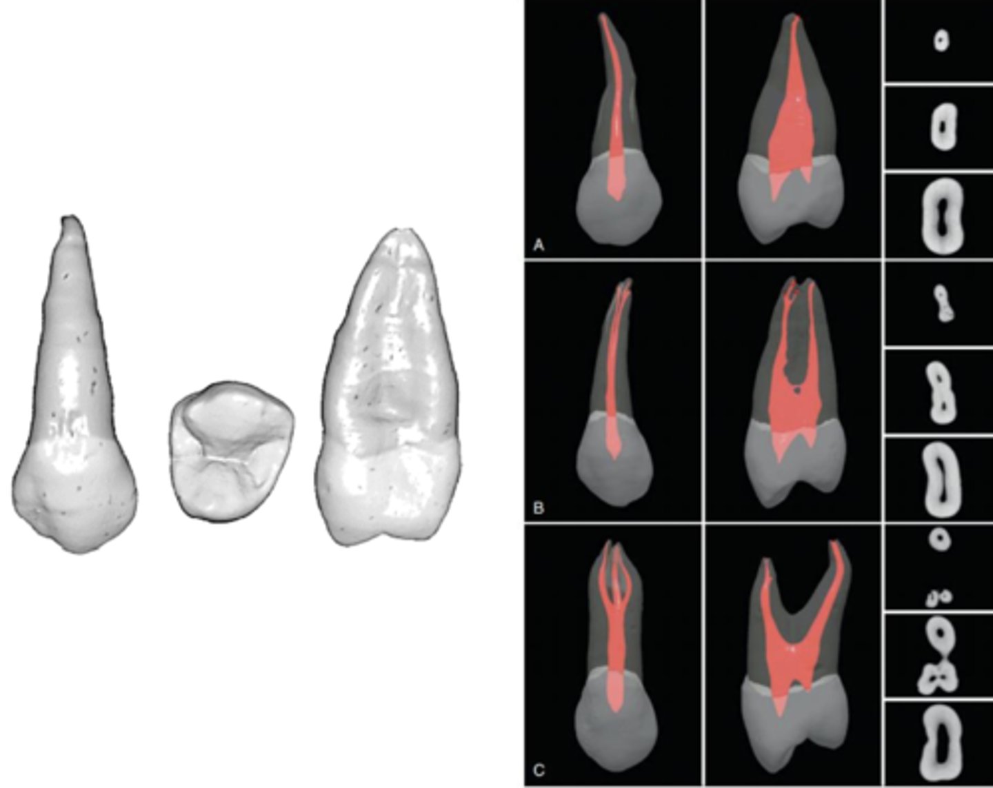 <p>maxillary 2nd premolar</p>