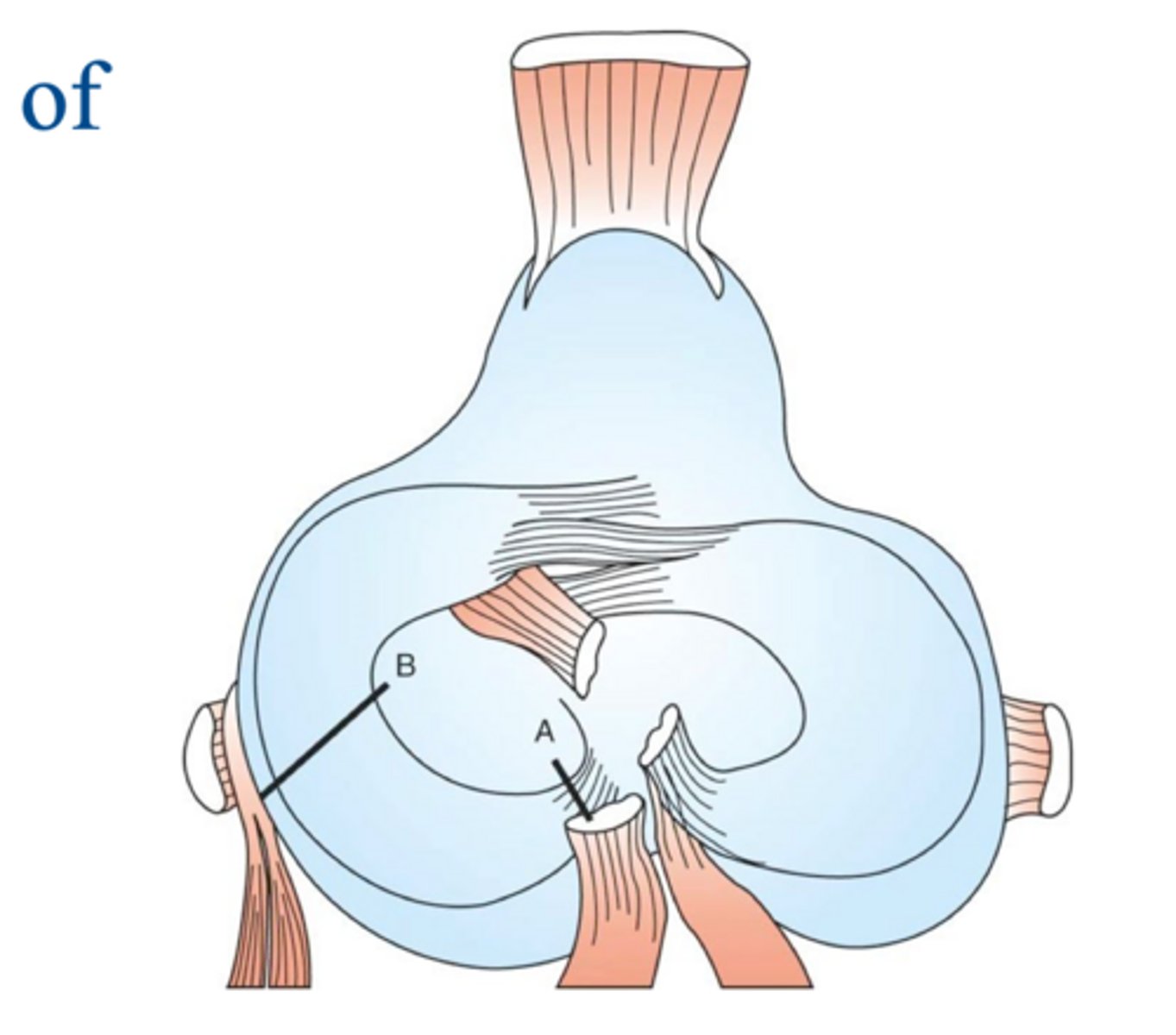 <p>what are the location of release of the medial meniscus...process of protecting medial meniscus following sx. stabilization of the stifle in a procedure such as a TPLO</p>