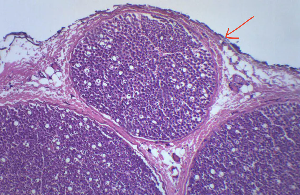 <p>What structure is shown (arrow)?</p>