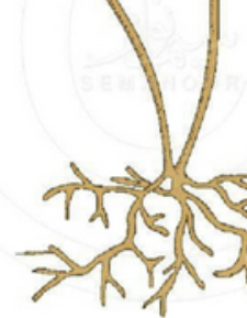 <p>What is the name for this hyphae structure <u>at the bottom</u>? </p>