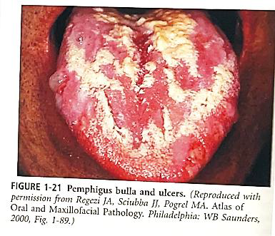 <ul><li><p>Identify the disease</p></li><li><p>Etiology</p></li><li><p>Clinical Features</p></li><li><p>4 types of pemphigus</p></li><li><p>Common features of the 4 types of pemphigus</p></li></ul><p></p>