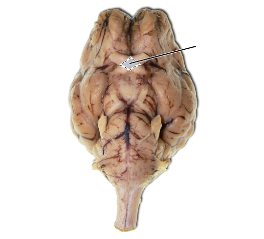 <p>Name the part of the brain that is highlighted.</p>