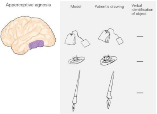 <p>Apperceptive agnosia</p><p>What it is and what are people unable to do </p>