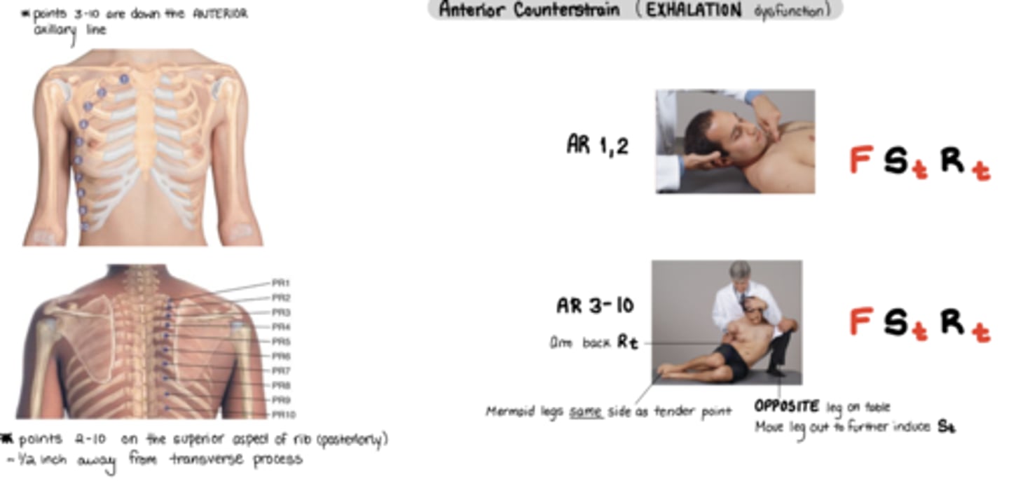 <p>F St Rt</p><p>ASS! - anterior same side -> pt mermaid legs same side as TP</p><p>* exhalation</p><p>Arm back = Rt</p><p>Physician moves leg out = further into St</p>