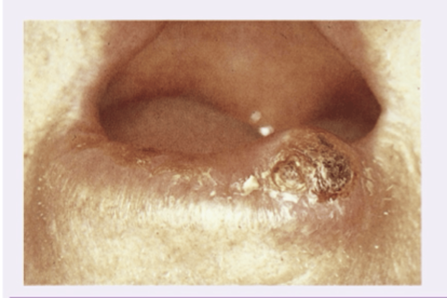 <p>Diagnosis?</p>