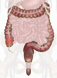 <p>large intestine </p>