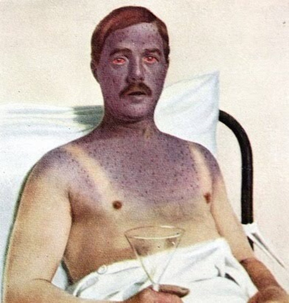 <p>condition caused by insufficient intake of oxygen</p>