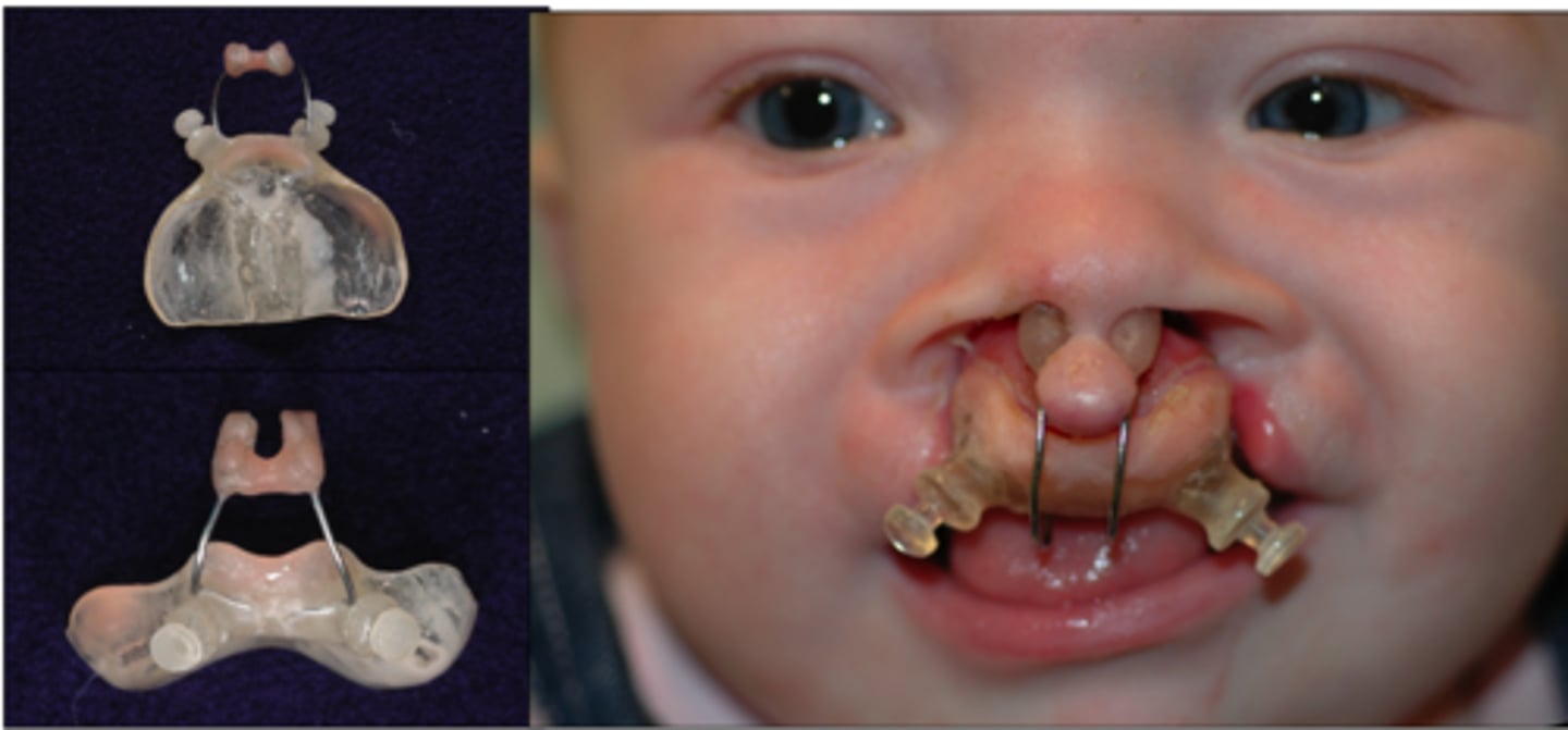 <p>label appliance</p>