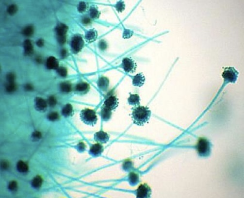 <p>Identify: Fungi</p>