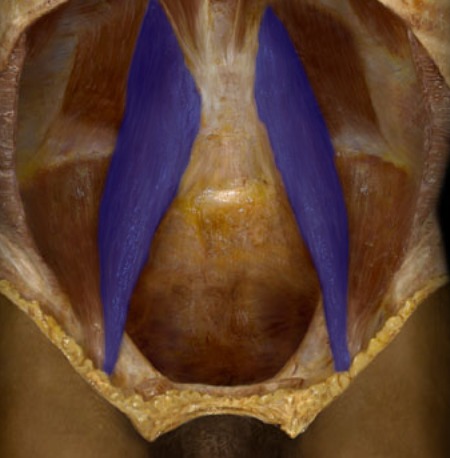 <p>medial, narrow bands, lumbar vertebrae to femur</p>