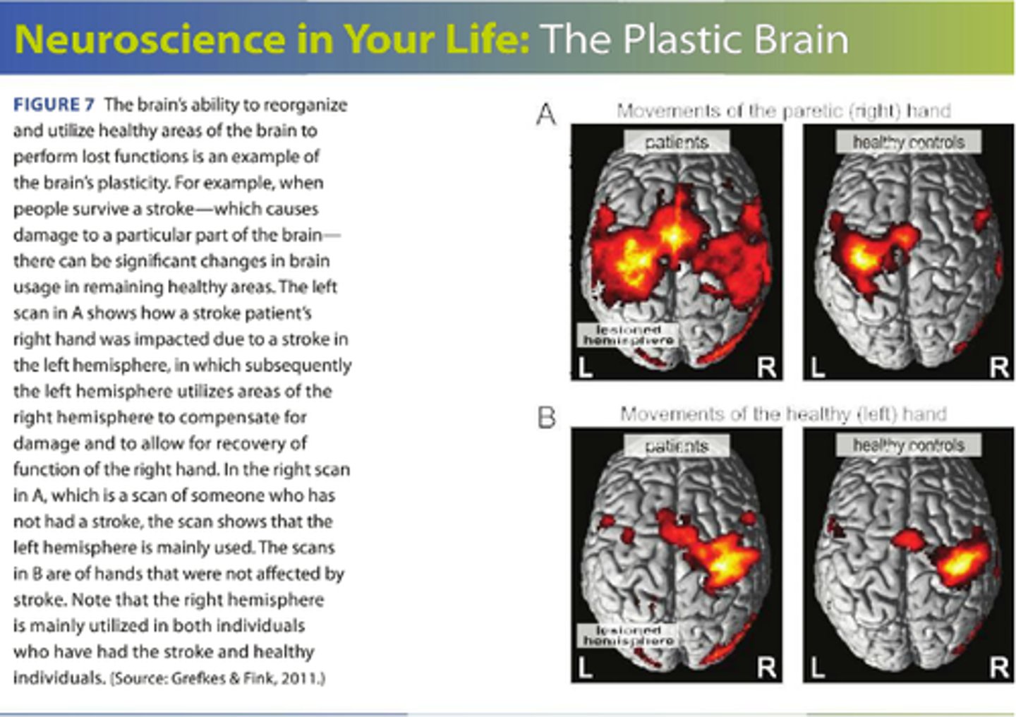 <p>the ability of other parts of the brain to take over functions of damaged regions. Declines as hemispheres of the cerebral cortex lateralize.</p>