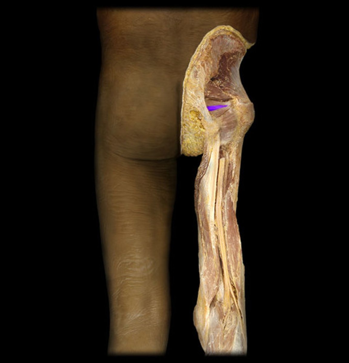 <p>internal pudendal and obturator artery</p>