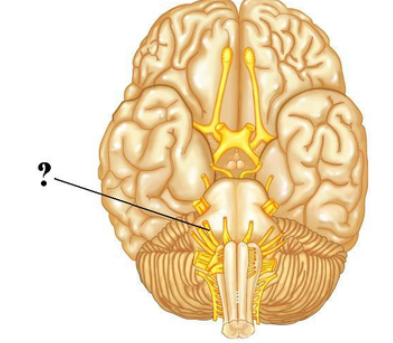 <p>Identify the indicated cranial nerve.</p>
