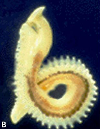 <ol><li><p><em><u>Multicalyx elegans</u></em></p></li><li><p>Holocephalans &amp; Elasmobranchs</p></li><li><p>Intestine </p></li><li><p>1 </p></li><li><p>1 Ventral </p></li></ol><p></p>
