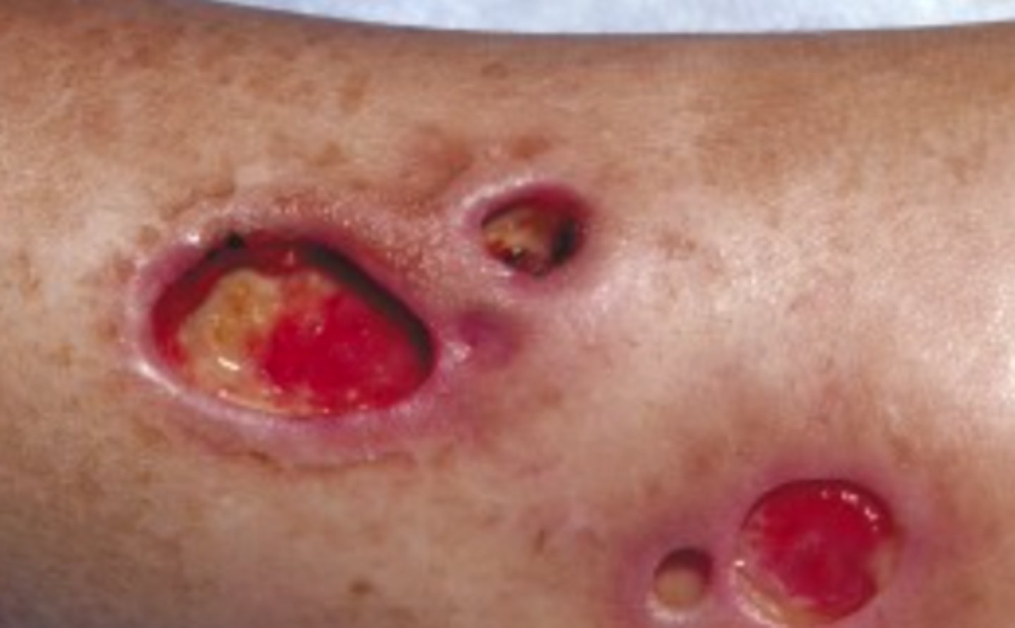 <p>What is the diagnosis?</p>