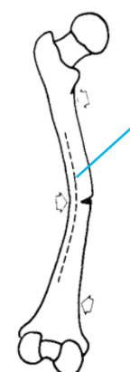 <p>the side experiencing tensile forces, NOT the compressed side</p>