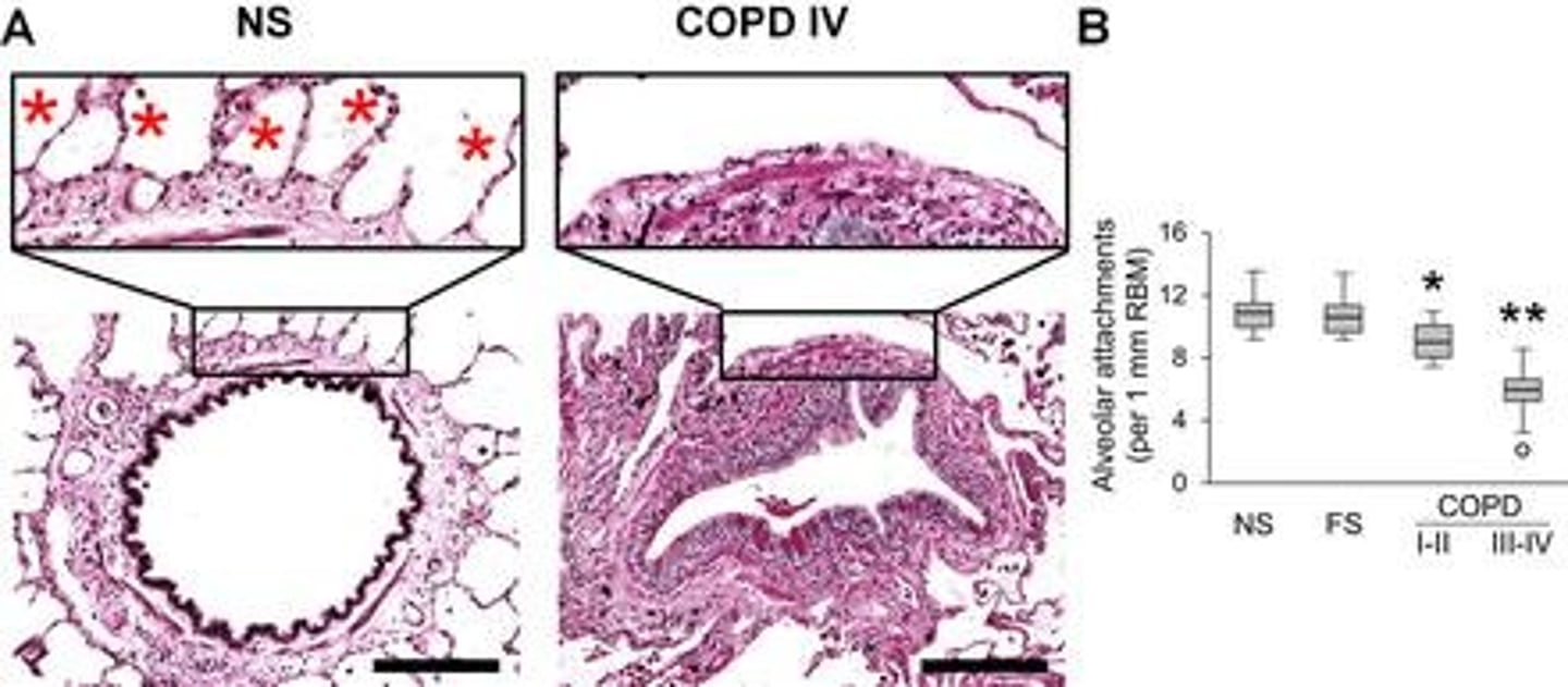 <p>Includes airway narrowing and loss of alveolar attachments.</p>