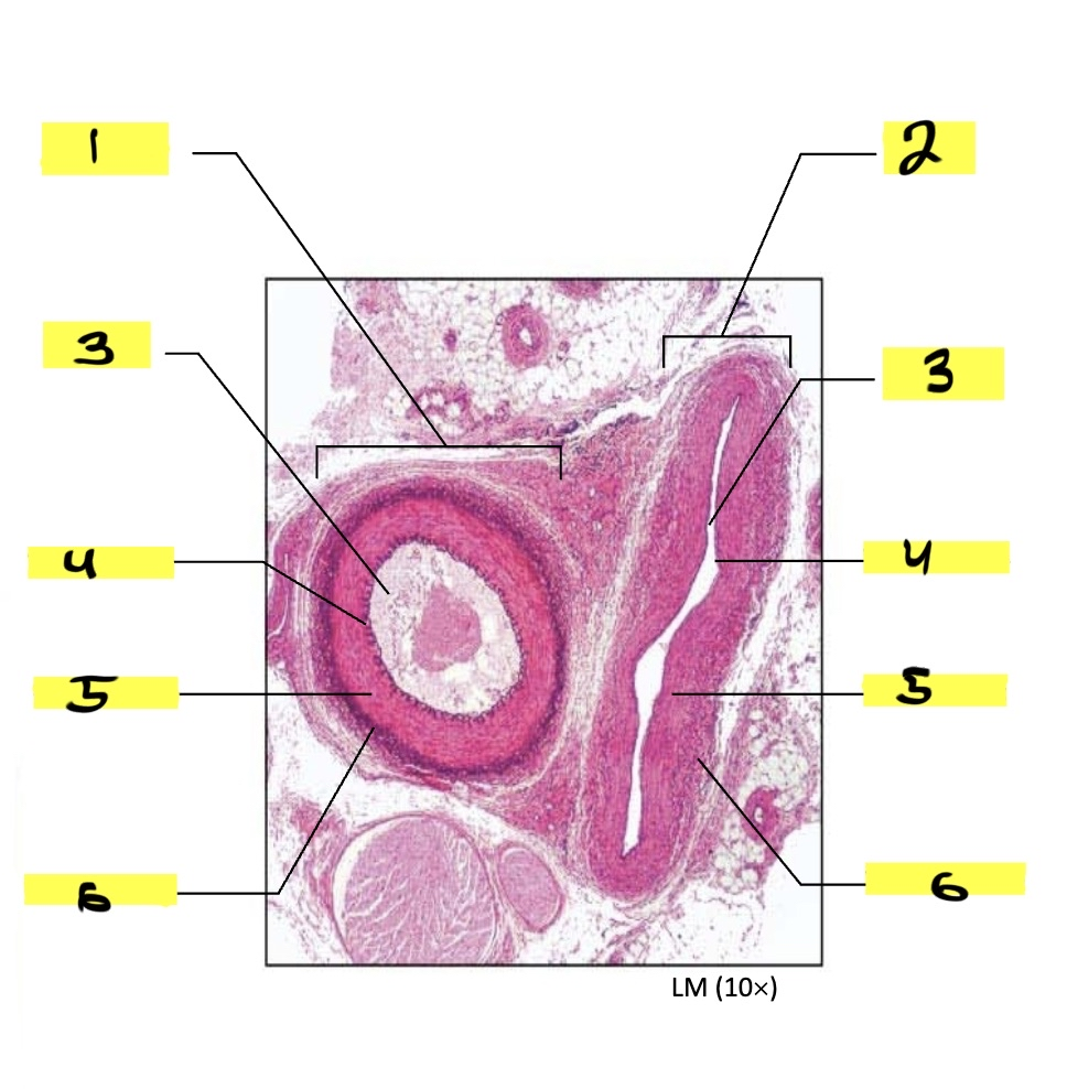 <p>what is #6 in this image?</p>