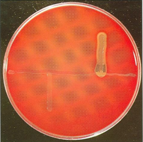 <ol><li><p>Lab Test</p></li><li><p>Horizontal</p></li><li><p>Left</p></li><li><p>Right</p></li><li><p>Which shows <strong>haemolysis enhancement</strong>? L or R </p></li></ol><p></p>