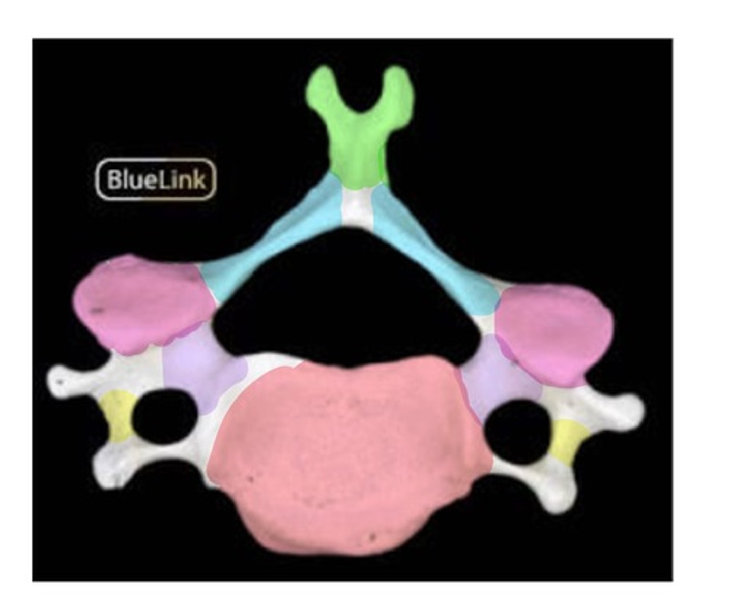 <p>indicate where the surgeon should cut through the vertebra in order to reveal the spinal cord</p>